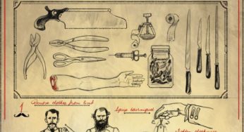 The Gentleman’s Guide to Amputation